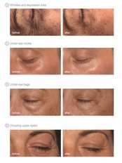 Global eyecon - Tara Skin Clinic