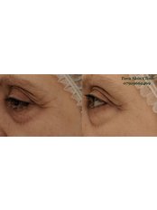 Global eyecon - Tara Skin Clinic