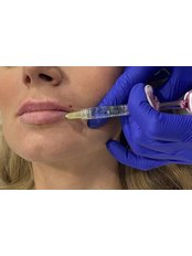 Lip Augmentation - The Aesthetic Treatment Rooms