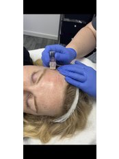 Mesotherapy - The Aesthetic Treatment Rooms