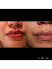 Lip blush in permanent makeup  - Lolica