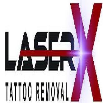 Laser X Tattoo Removal - Sydney