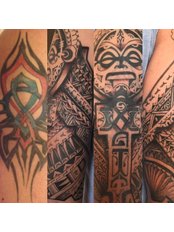 Tattoo Removal, Modify or Fade - No Regrets Laser Tattoo Removal