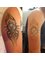 No Regrets Laser Tattoo Removal - 3 treatments... Fade for Cover-up 