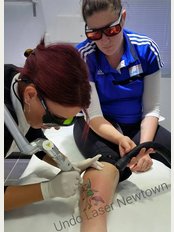 Undo Laser Tattoo Removal - Suite 4, 82-84 Enmore Road, Newtown, NSW, 2042, 