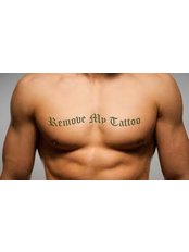 Body Treatment - Bodyclinic Tattoo Removal WA