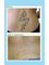 Bodyclinic Tattoo Removal WA - Eramosa Medical Clinic - Mornington Peninsula, 61 Eramosa Rd, Somerville, VIC, 3912,  2