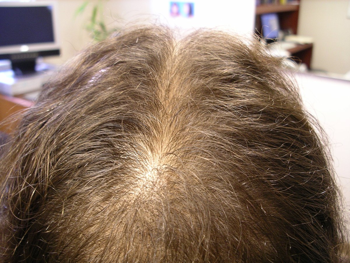 Antech Hair and Skin Clinics - Toronto • Read 3 Reviews
