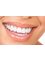 Laser Teeth Whitening Dublin - laser teeth whitening dublin 