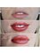 Art Permanent Make Up - permanent make up lips 