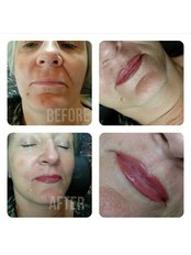 Full lip colour - Tan Wright Permanent Makeup for 'A Perfect You'