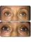 Geraldine Ridgway - Lower lash Enhancement with Permanent makeup 