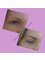 Carefree Beauty Studio - Brow tails missing - so much nicer after treatment! 