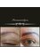 Permanentlyou Ltd - Provided shape and uplift for cleint who had very few eyebrow hairs and scar. 
