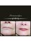 Permanentlyou Ltd - Gorgeous defined lips from extremely thin lines 