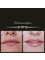 Permanentlyou Ltd - Gorgeous ombre lips using two colours gives this effect of lightening 