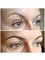 Abby Stacey - Advanced Skin Treatment - Bedlington - Fuller looking brow 