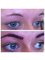 Abby Stacey - Advanced Skin Treatment - Bedlington - Fuller looking brow 