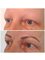 Abby Stacey - Advanced Skin Treatments - On Tyne - Hair stroke eye brows - alopecia 