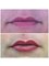 Abby Stacey - Advanced Skin Treatments - On Tyne - Semi permanent lip liner and blush 