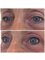 Abby Stacey - Advanced Skin Treatments - On Tyne - Eye liner top and bottom 