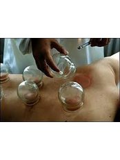 Cupping - Body and Health Creation