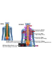 Chiropractor Consultation with spinal analysis & report of findings - Kiro Nilsson