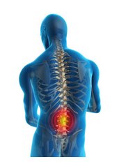 Back Pain Treatment - Riverside Chiropractic Clinic