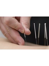 Acupuncturist Consultation - Chiropractic and Complementary Medical Centre