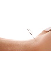 Acupuncturist Consultation - Wellbeing Clinic