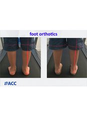 Foot Orthotics - American Chiropractic Clinic Ho Chi Minh City
