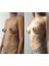 SM Cirugía Plástica - Breast implant, Liposuction 