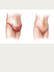 Cairo Slim Clinic - We will rid you of fat!