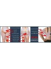 Liposuction - Dr Mohamed El Assal Plastic Surgery Clinic
