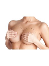 Breast Implants - Hatzipieras Plastic Surgery