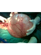 Myomectomy - Bhopal Surgery