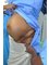 ROYS COSMETICSURGERY CENTRE - Pendulous abdomen before tummy tuck left side 