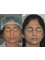 Rhinoplasty Clinic Bhatia Hospital - croocked nose correction  