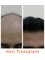 Kalosa - Hair & Cosmetic Clinic-New Delhi - B-33,34,, Qutab Institutional Area ,Tara Crescent Road, New Delhi, 110016,  22