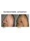 Dr Bakshi Cosmetic Clinic - gynaecomastia/male breast correction. 