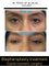 DR PRINCE PLASTIC & COSMETIC CLINIC - eyelid correction kerala 