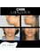 DR PRINCE PLASTIC & COSMETIC CLINIC - chin implant surgery 