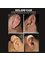 DR PRINCE PLASTIC & COSMETIC CLINIC - ear keloid surgery 