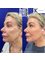 Kenneth Kok Plastic Surgery Clinic - facelift and neck lift 