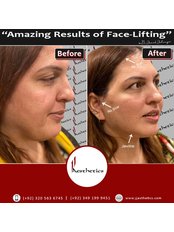 Mini Facelift - JJ Aesthetics - Hair Transplant & Skin Clinic in Islamabad
