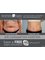 Aesthetic Shapes - Liposuction Before & After Results  