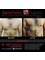 Aesthetic Shapes - gynecomastia Surgery Before & After 