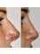 Laser Praxis Cosmetic Surgery & Liposuction Clinic - 50 D-1/A, off M. M. Alam Road, Gulberg III, Lahore, Punjab, Pakistan, Lahore, Pakistan, 54000,  4