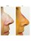 ClinicForYou - Nose Surgery Before&After 