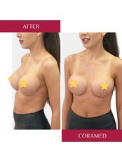Breast Implant Revision - CORAMED Beauty Surgery